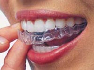 San Mateo Invisalign Services